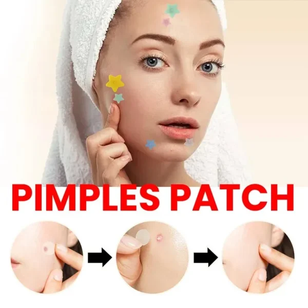 Repair Acne Patch Facial Skin Care Fade Blemishes Pimple Marks Closed Acne Blemishes Cover Acne Pimple Repair Patch - Image 5