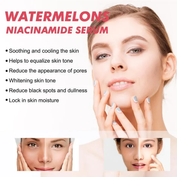 Watermelon Glow Niacinamide Moisturize Serum,Moisturizing Facial Serum W/ Hyaluronic Acid Vitamin E,Hydrating Brighten Skincare