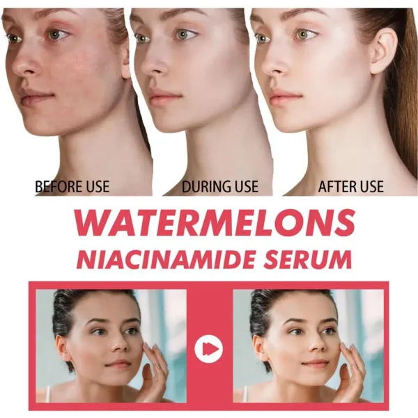 Watermelon Glow Niacinamide Moisturize Serum,Moisturizing Facial Serum W/ Hyaluronic Acid Vitamin E,Hydrating Brighten Skincare