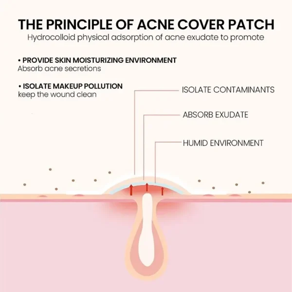 Repair Acne Patch Facial Skin Care Fade Blemishes Pimple Marks Closed Acne Blemishes Cover Acne Pimple Repair Patch - Image 4